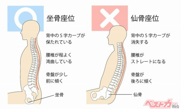 座っているときは、腰椎の生理的な前弯（横からみたときに、背骨がお腹側に向かってカーブしている状態）を保つのが腰に負担がかからない。のけぞった姿勢は楽に感じるが、腰に負担をかけてしまう（PHOTO：Adobe Stock_Tyrol）