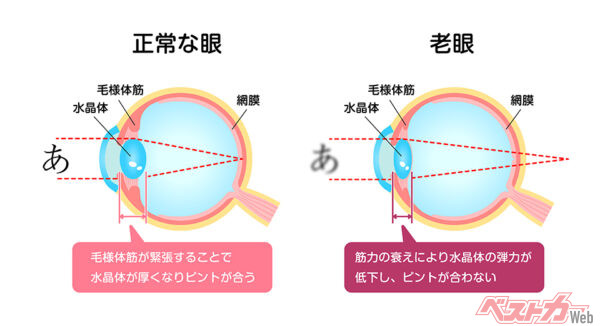 毛様体筋の衰えによりピント調節機能が低下することを「老眼」という（barks＠AdobeStock）